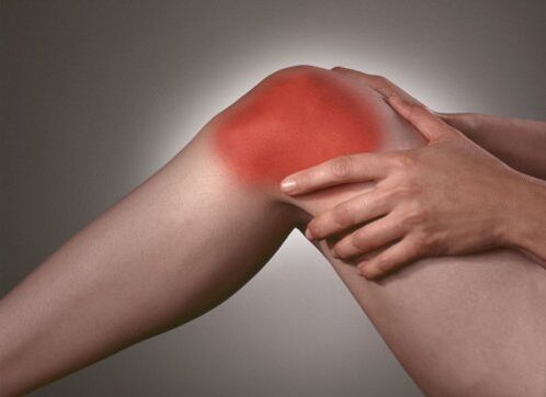 Artrosis de la articulación de la rodilla