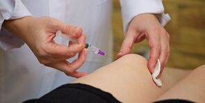 Inyecciones de ácido hialurónico en la articulación de la rodilla
